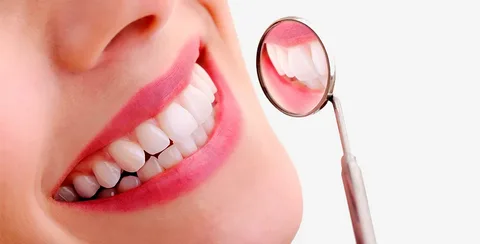 Hollywood Smile in Dubai