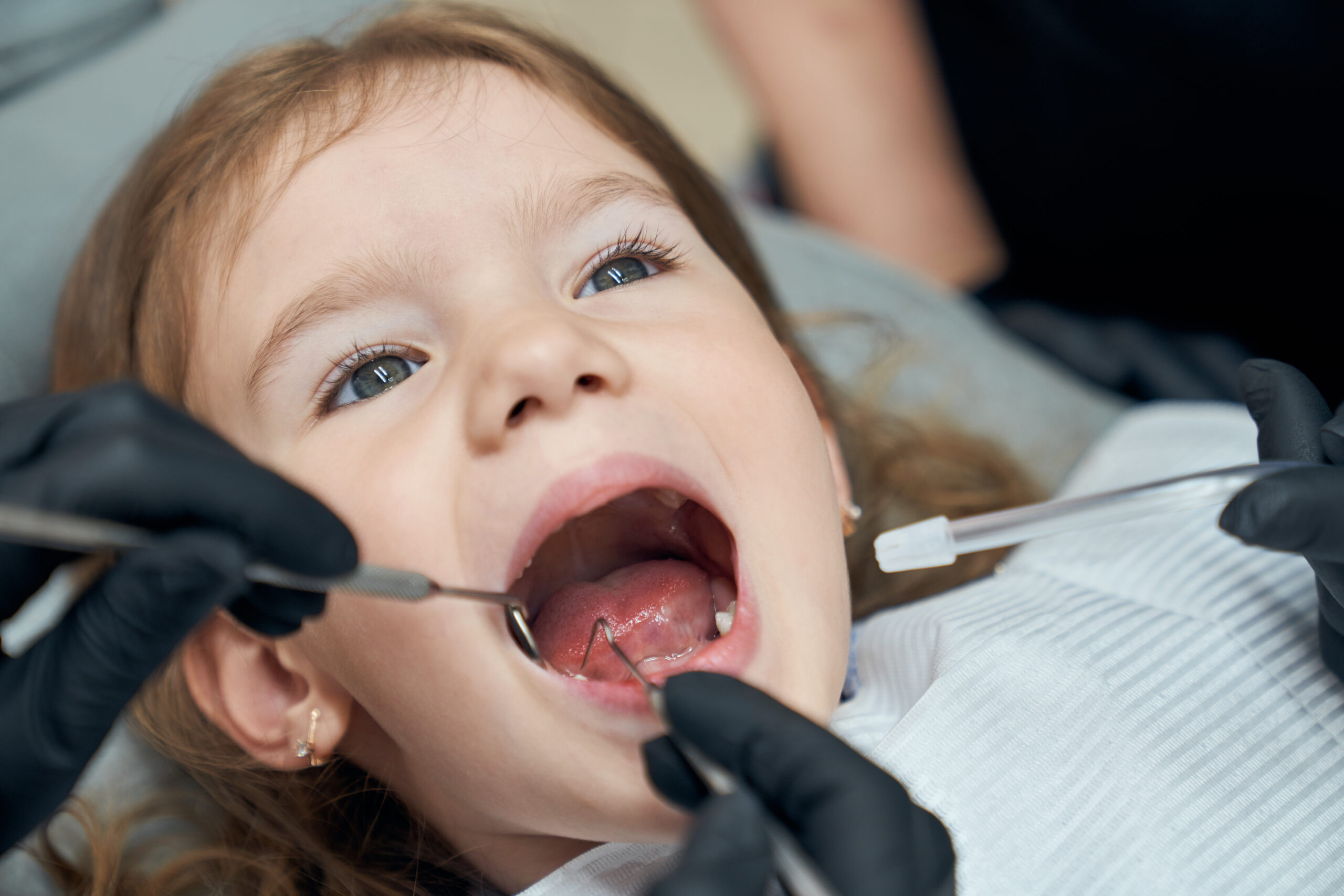 Why early dental visits are crucial for children